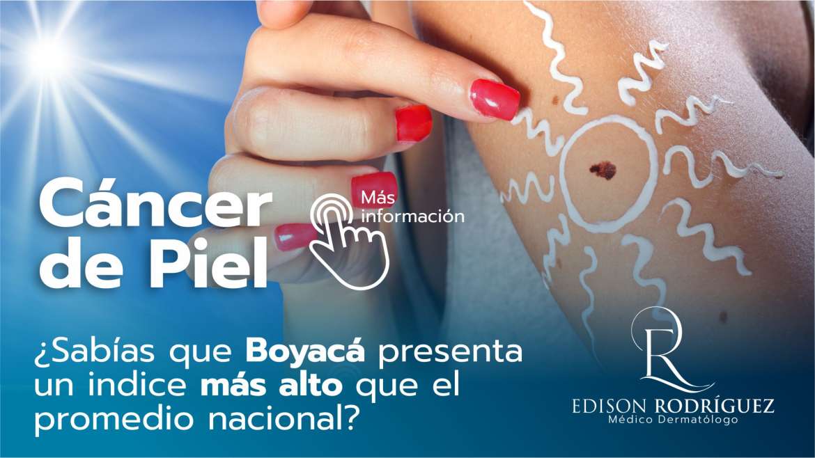 UPTC fabrica material de bajo costo para el tratamiento de cáncer de pie