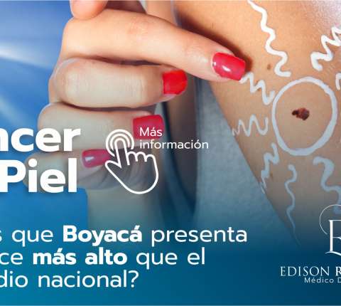 UPTC fabrica material de bajo costo para el tratamiento de cáncer de pie